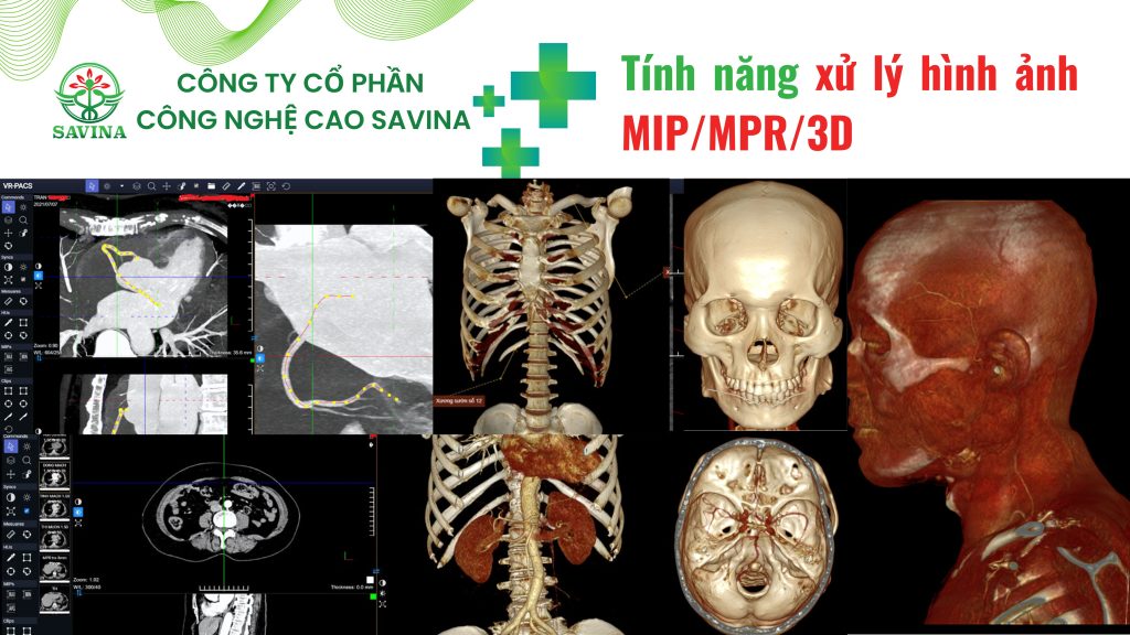 7 Lợi Ích Của Enterprise Radiology Và Giải Pháp VR-PACS Trong Y Tế 2 7 Lợi Ích Của Enterprise Radiology Và Giải Pháp VR-PACS Trong Y Tế