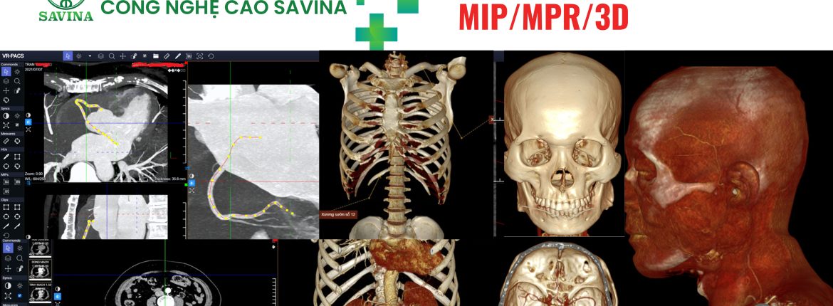 7 Lợi Ích Của Enterprise Radiology Và Giải Pháp VR-PACS Trong Y Tế 1 7 Lợi Ích Của Enterprise Radiology Và Giải Pháp VR-PACS Trong Y Tế