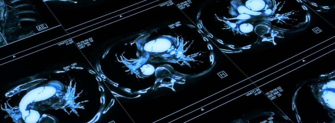 Tìm Hiểu Sâu Về DICOM VRs & Tags: Chìa Khóa Thành Công Trong Triển Khai PACS Và Medical Imaging 1 Tìm Hiểu Sâu Về DICOM VRs & Tags: Chìa Khóa Thành Công Trong Triển Khai PACS Và Medical Imaging