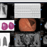 Lập trình DICOM Web tùy chỉnh là gì? Giải pháp hình ảnh y khoa trên nền tảng web