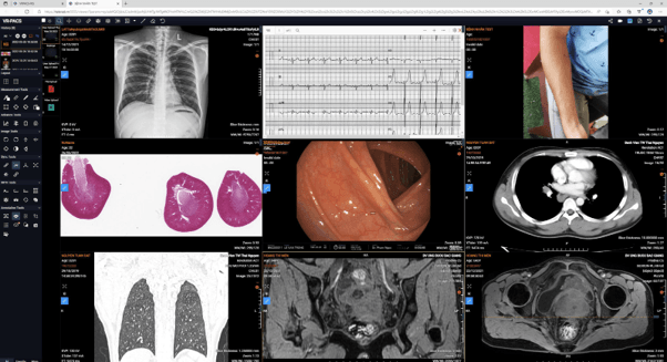 Lập trình DICOM Web tùy chỉnh là gì? Giải pháp hình ảnh y khoa trên nền tảng web