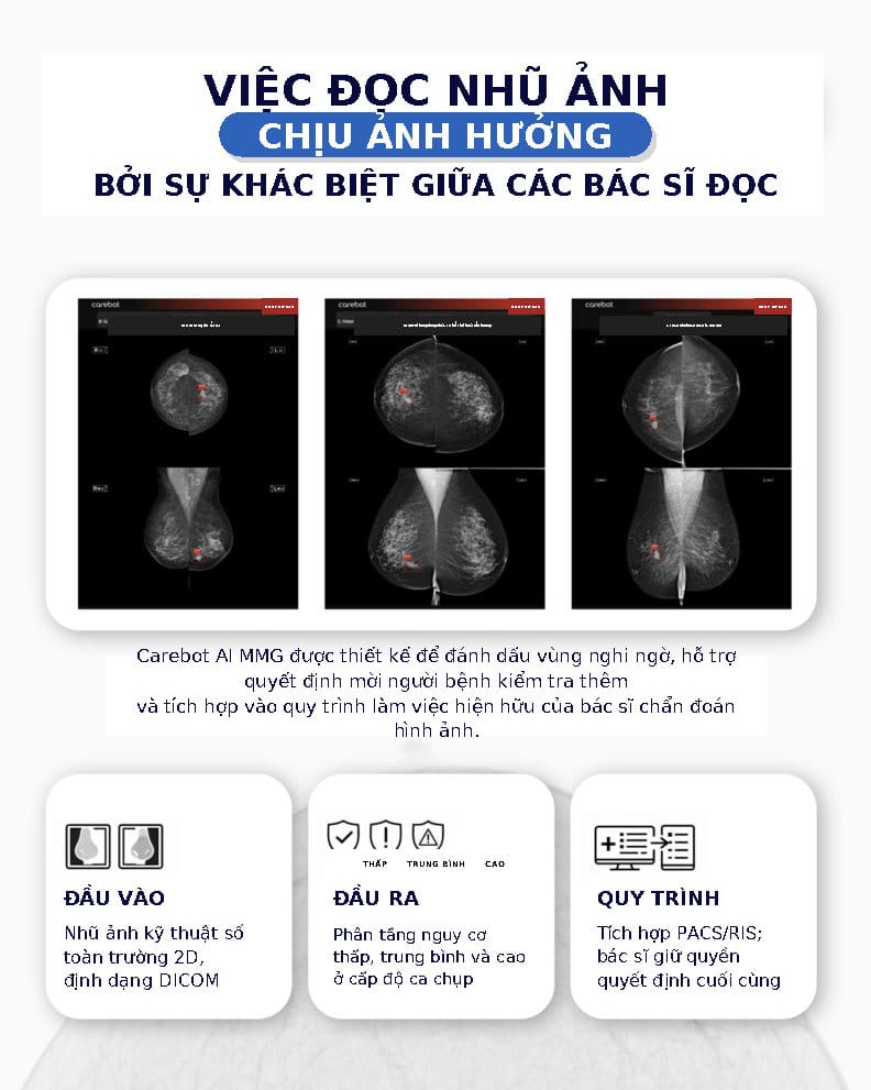 AI trong chụp nhũ ảnh: Lớp an toàn giúp giảm bỏ sót? 3 Carebot AI MMG Nghien cuu ban tieng Viet Page2