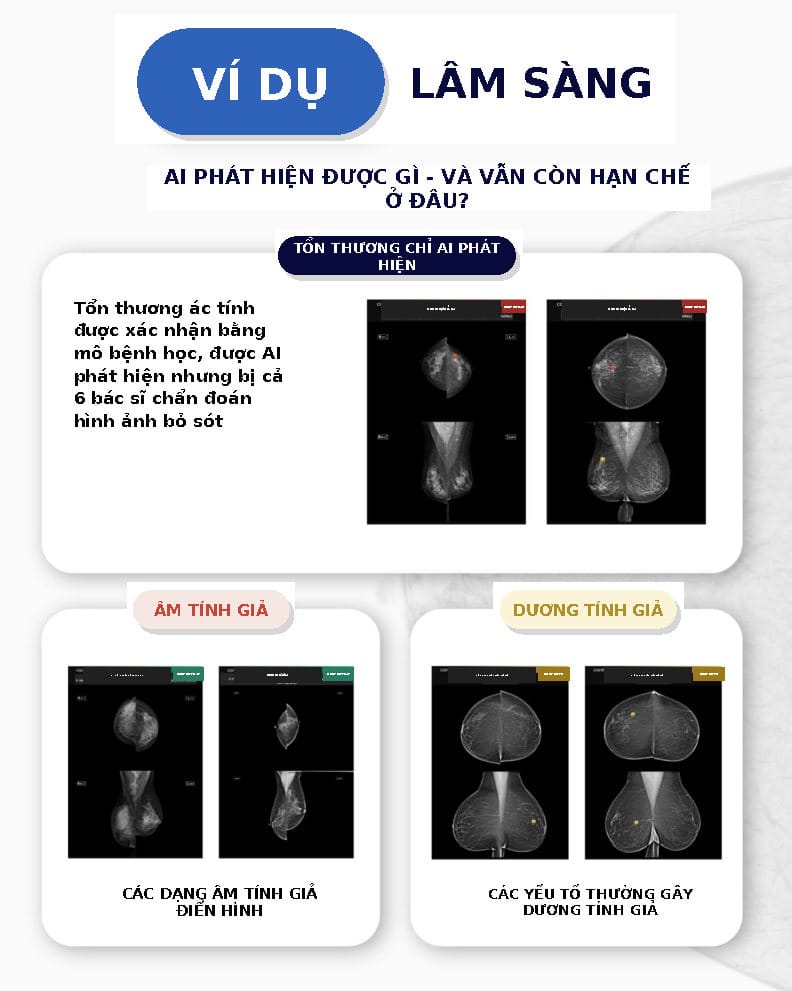 AI trong chụp nhũ ảnh: Lớp an toàn giúp giảm bỏ sót? 2 AI trong chụp nhũ ảnh